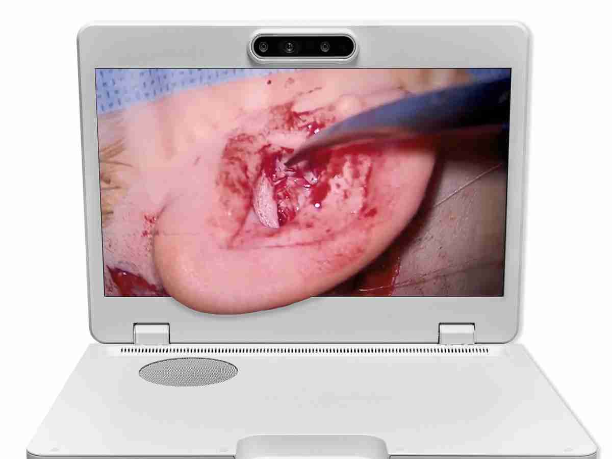 达擎之＂Heads-up 3D显微手术显示系统＂，，，整合4K裸眼3D显示及眼球追踪系统，，，具备快速追踪人眼移动位置功能，，，减轻医师长时间维持固定姿势的负担，，，，让医师能有更宽广清晰的3D立体视野及更舒适的姿势来执行手术。。。